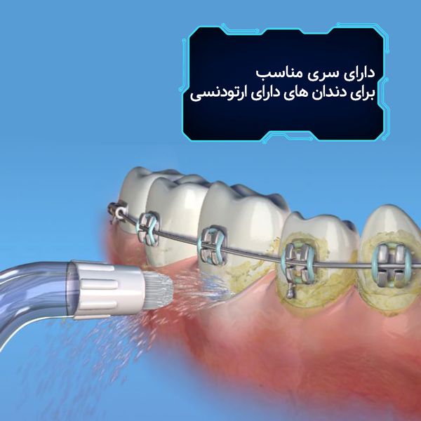 دستگاه شست و شوی دهان و دندان هارمن مدل MOTOJET AOW04