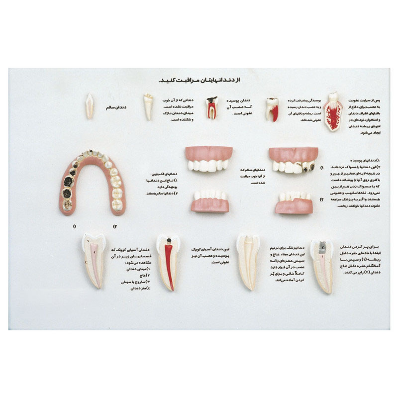 بازی آموزشی مدل دیواری آناتومی مراقبت از   دندان‌ ها