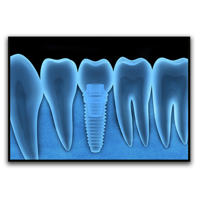 تابلو نوری بکلیت طرح دندان مدل B-D1169