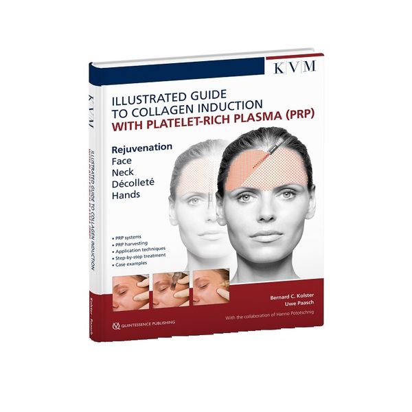 کتاب Illustrated Guide to Collagen Induction with Platelet-Rich Plasma PRP اثر Bernard C.Kolster Uwe Paacsh انتشارات QUINTESSENCE