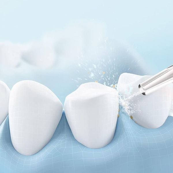 دستگاه شست و شوی دهان و دندان مدل Oral Irrigator-CY8