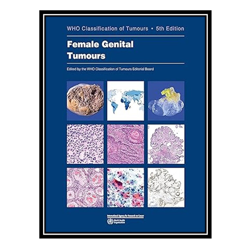 کتاب Female Genital Tumours: WHO Classification of Tumours اثر WHO Classification of Tumours Editorial Board انتشارات مؤلفین طلایی
