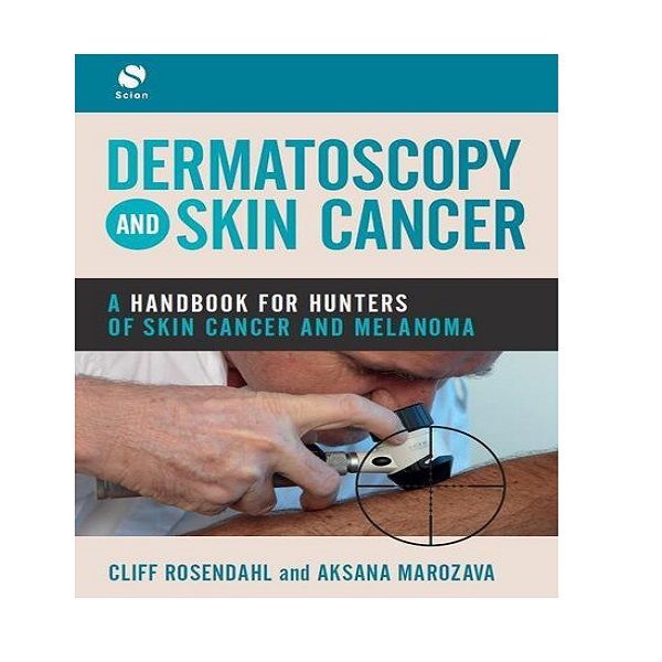 کتاب Dermatoscopy and Skin Cancer اثر Cliff Rosendahl And Aksana Marozava انتشارات SCION