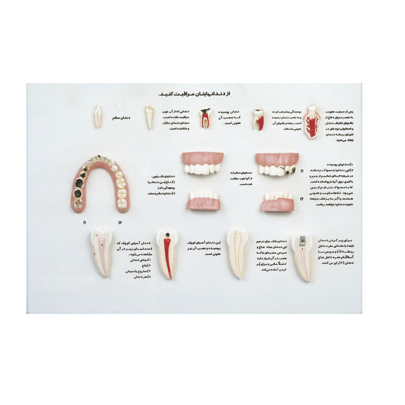 بازی آموزشی مدل دیواری آناتومی مراقبت از   دندان‌ ها